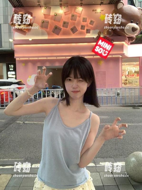 提醒！听说“网曝吃瓜”有永久的贴士，为啥我觉得脑袋要炸了？